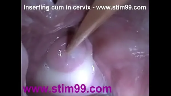 Beste Insertion Semen Cum im Cervix Wide Stretching Pussy Speculumfrische Videos